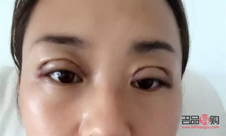 最適合做雙眼皮的眼睛(最適合做雙眼皮的眼睛圖片)