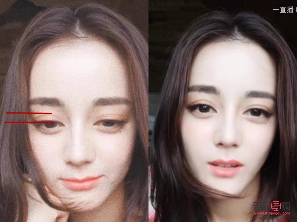 明星雙眼皮前后對照圖圖片(明星雙眼皮前后對照圖圖片女)