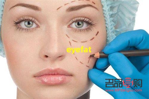 眼部抽脂手術(shù)過(guò)程(眼部抽脂手術(shù)過(guò)程圖片)