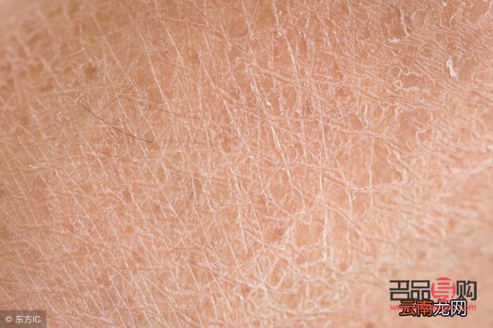 身體干燥怎么護(hù)理最好(身體干燥怎么護(hù)理最好呢)