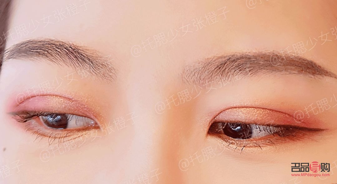 <h3>雙眼皮手術(shù)價(jià)格種類全解析</h3>