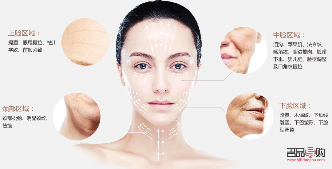 什么是美容提拉線(什么是美容提拉線的作用)