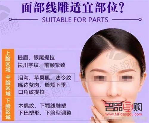 什么是美容提拉線(什么是美容提拉線的作用)