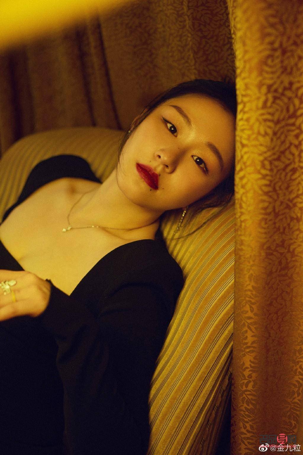 腫眼泡割雙眼皮案例(什么年齡割雙眼皮最好)