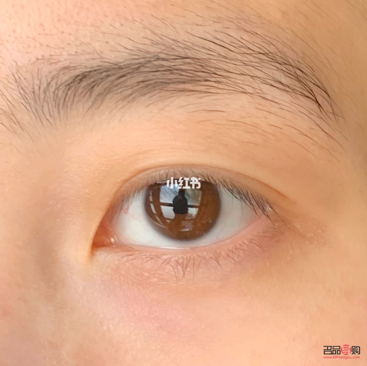 三眼皮怎么變回雙眼皮(三眼皮怎么變回雙眼皮學(xué)生)