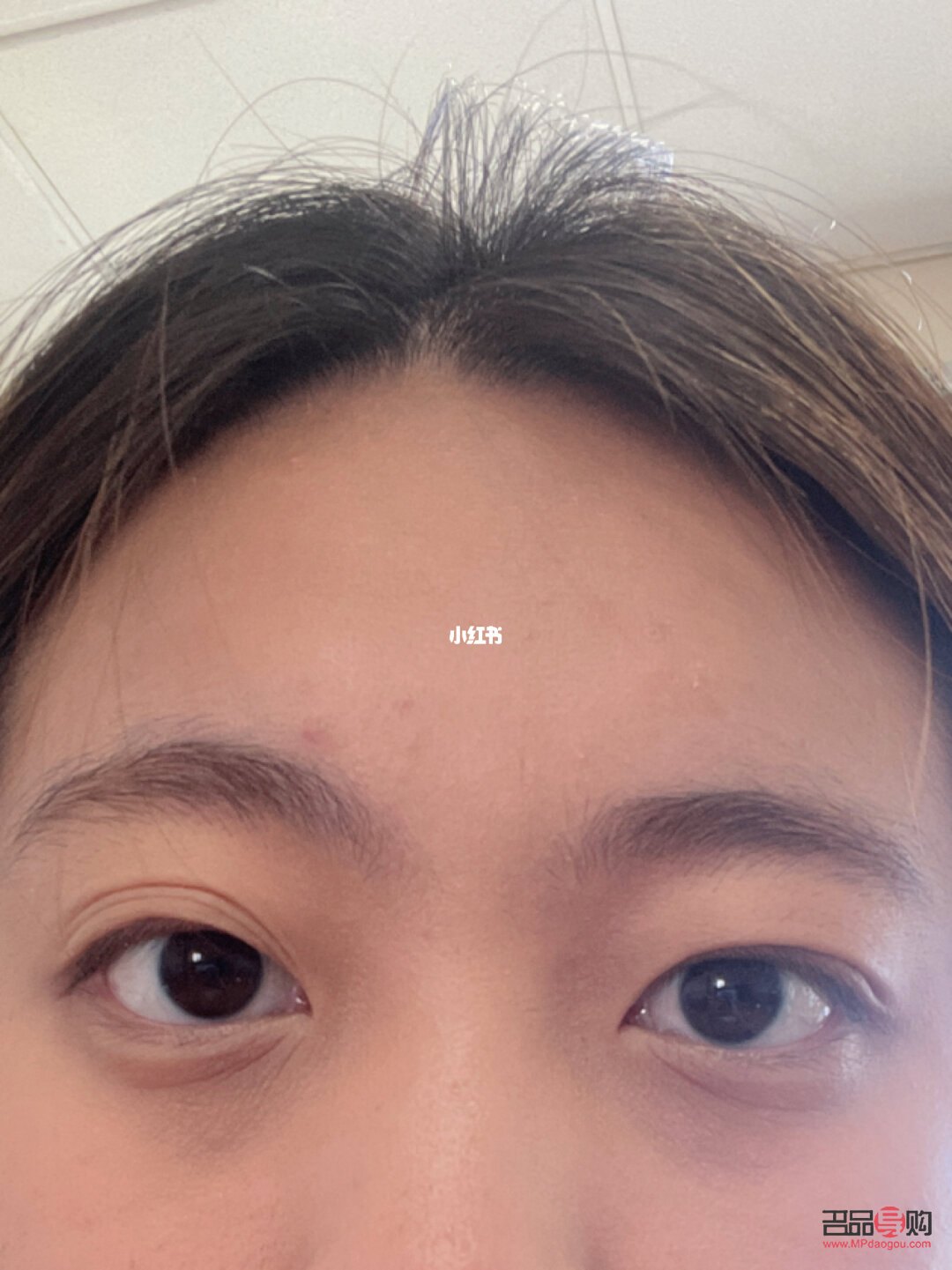 三眼皮怎么變回雙眼皮(三眼皮怎么變回雙眼皮學(xué)生)