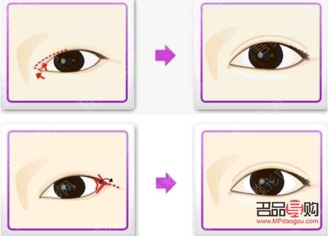 開外眼角圖片大全(開外眼角圖片大全大圖)