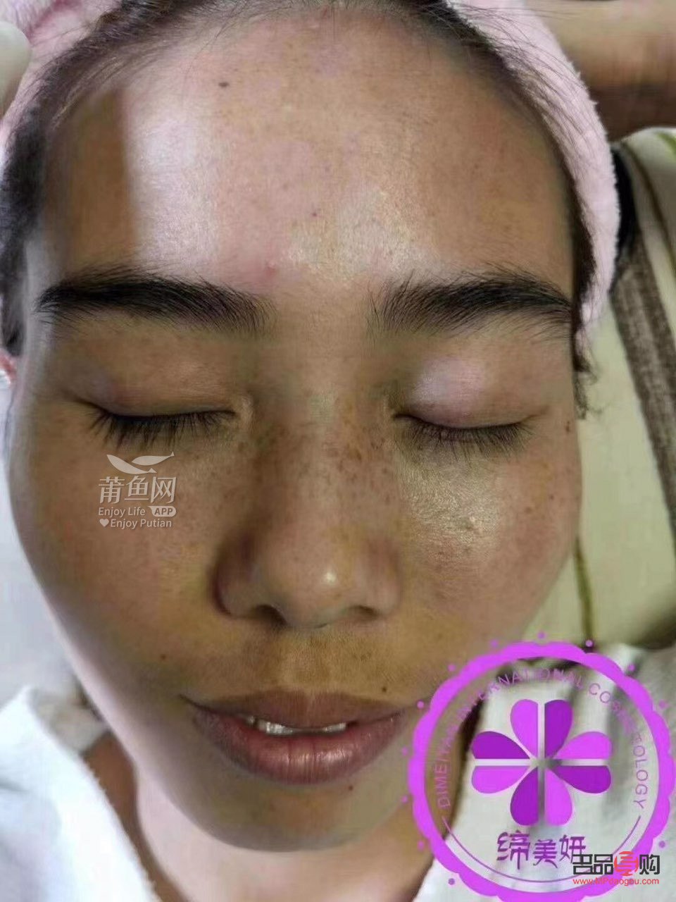 <h3>尋找最佳祛斑美容圣地</h3>