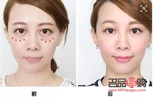 鑫匯美容祛眼袋地址(鑫匯美容祛眼袋地址在哪里)