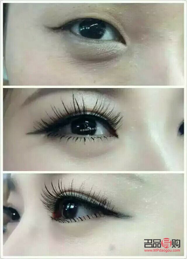 <h3>單眼皮學(xué)生如何自然變雙眼皮</h3>