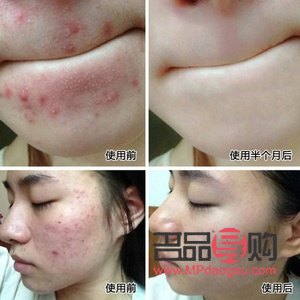 豆豆身體護(hù)理怎么做(豆豆身體護(hù)理怎么做視頻)