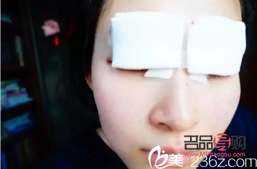 開扇雙眼皮怎么做視頻(開扇雙眼皮怎么做視頻教程)