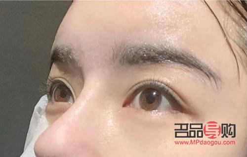 開扇雙眼皮怎么做視頻(開扇雙眼皮怎么做視頻教程)