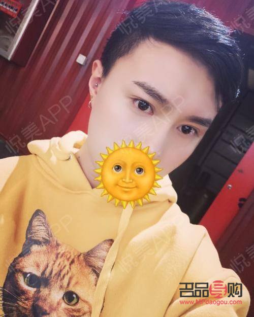 半切雙眼皮和全切雙眼皮哪個好(半切雙眼皮和全切雙眼皮哪個好一點)