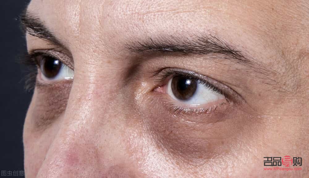 眼袋黑眼圈好重怎么辦(眼袋黑眼圈好重怎么辦圖片)