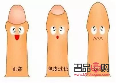 龜頭美容是什么