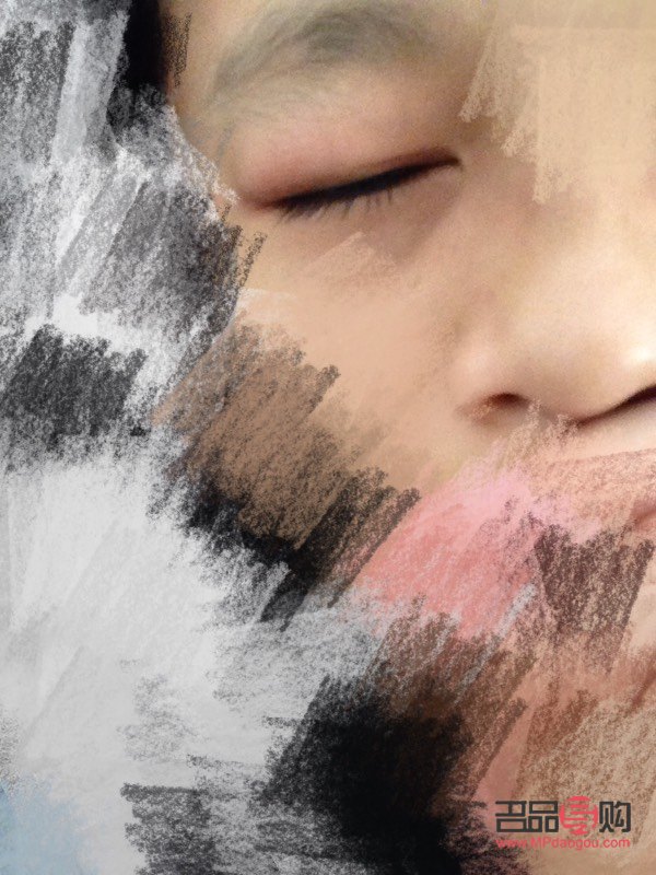 天生腫眼如何快速消腫