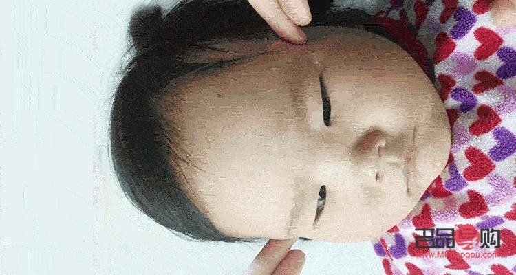 眼角塌陷怎么回事(眼角塌陷怎么回事圖片)