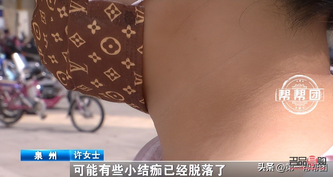 美容會(huì)痛嗎？解析美容過(guò)程中的疼痛感受