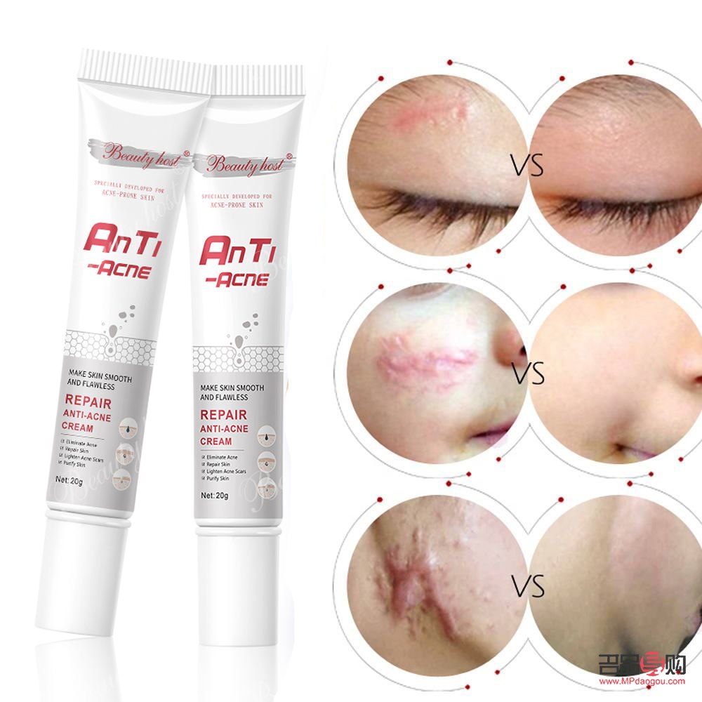 <h3>美容院去疤痕的有效方法</h3>