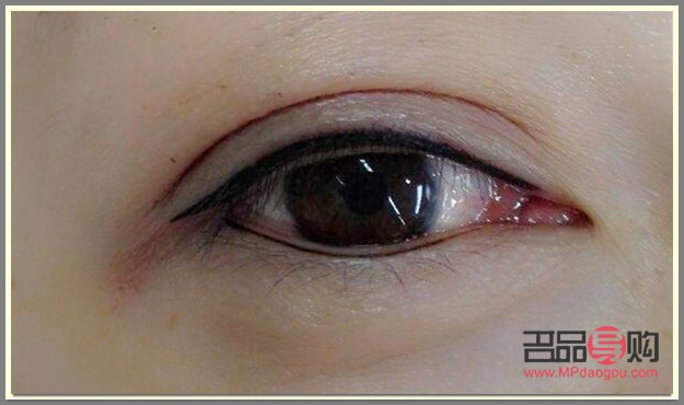 紋眼線怎么洗掉多少錢(紋眼線怎么洗掉視頻)