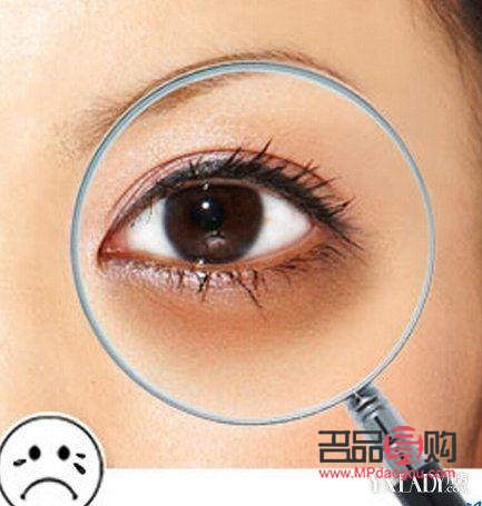 十幾年的黑眼圈怎么去除(十幾年的黑眼圈怎么去除掉)