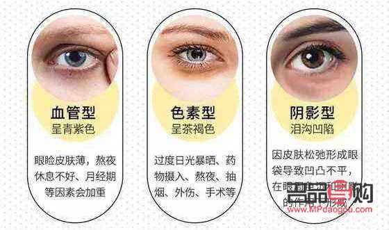 十幾年的黑眼圈怎么去除(十幾年的黑眼圈怎么去除掉)