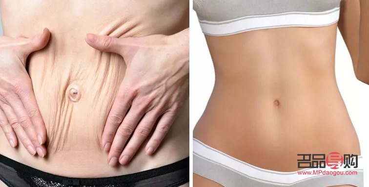 <h1>身體過敏后的護(hù)理之道</h1>