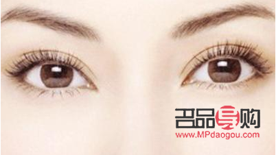 全切雙眼皮恢復(fù)之路：時(shí)間與自然的完美融合