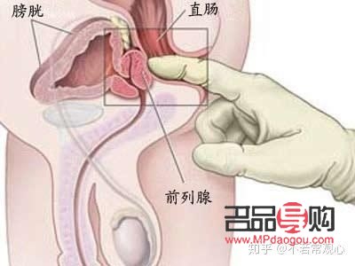男性前列腺美容嗎(男性前列腺美容嗎能治好嗎)