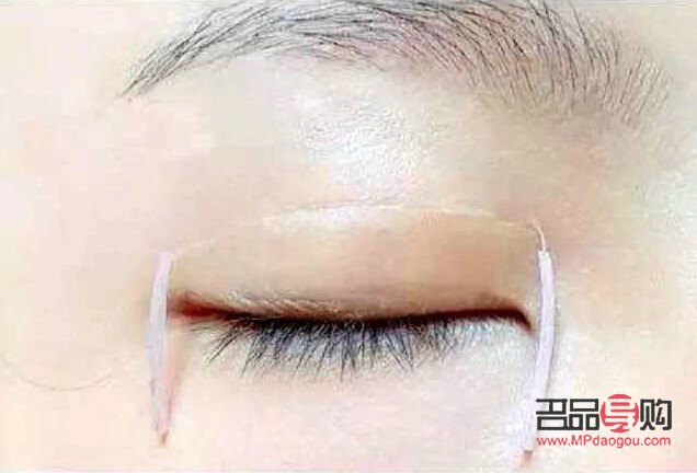 雙眼皮貼選擇指南：打造自然迷人電眼