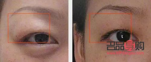 腫眼泡應(yīng)該怎么改善(腫眼泡怎么改善啊)