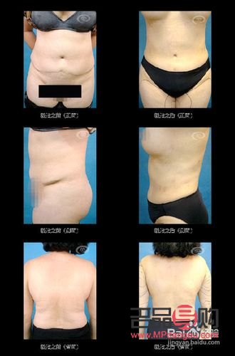 女性身體護理全攻略