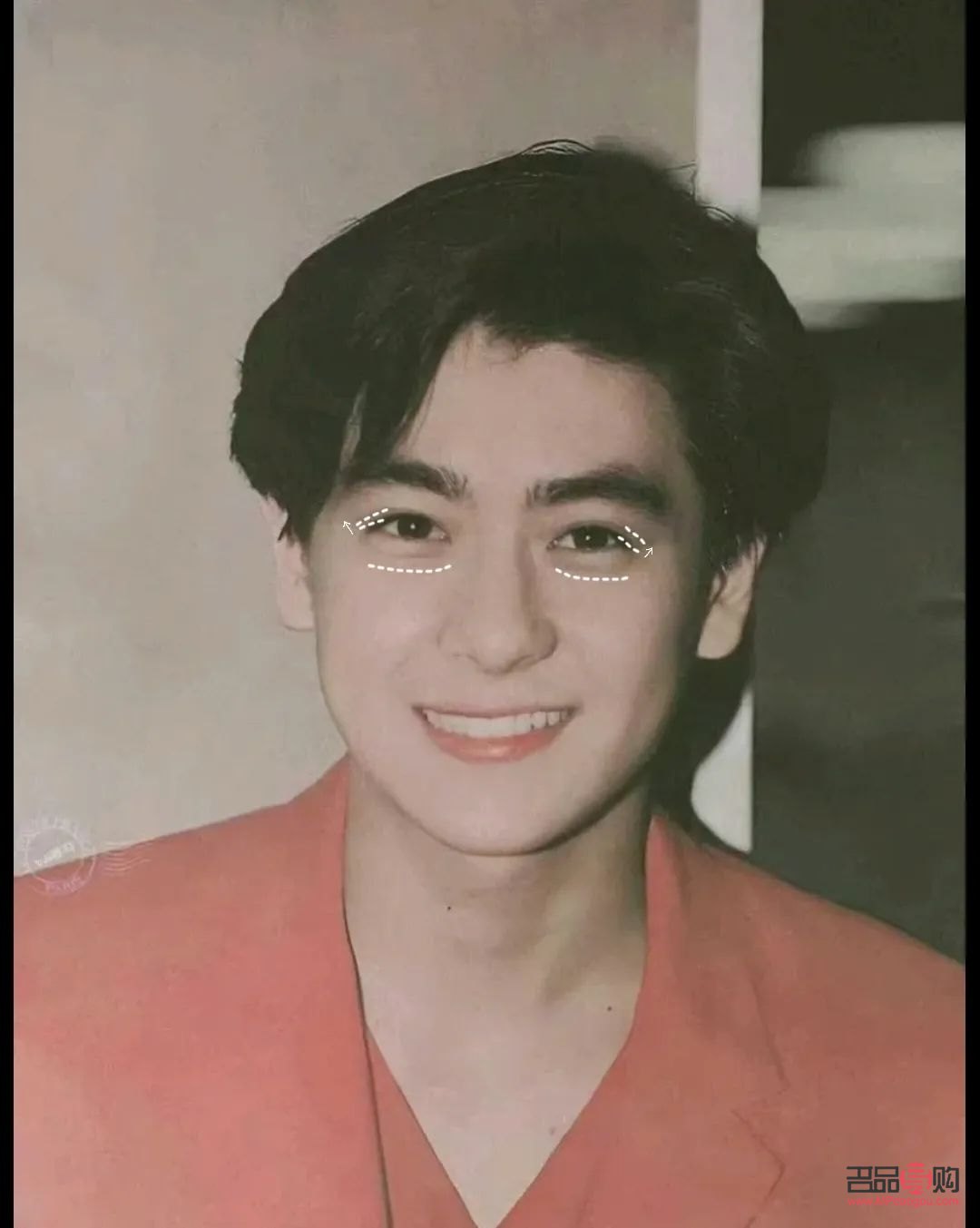 <h3>開扇雙眼皮：魅力眼神的秘訣</h3>