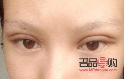 雙眼皮肉條感是什么樣子(雙眼皮肉條感是什么樣子的)