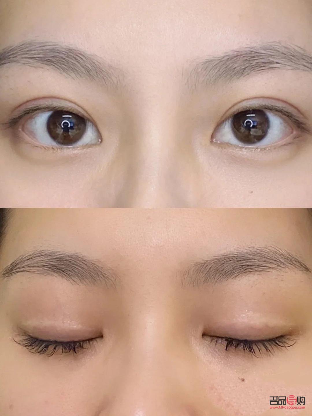 無痕雙眼皮是什么意思圖片(無痕雙眼皮是什么意思圖片女)