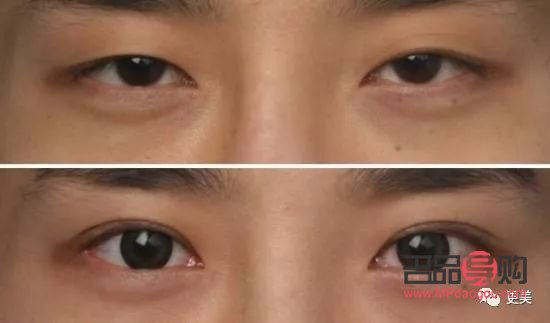 如何提升上眼皮肌肉(如何提升上眼皮肌肉層次)