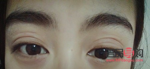 三眼皮(三眼皮怎么恢復雙眼皮)