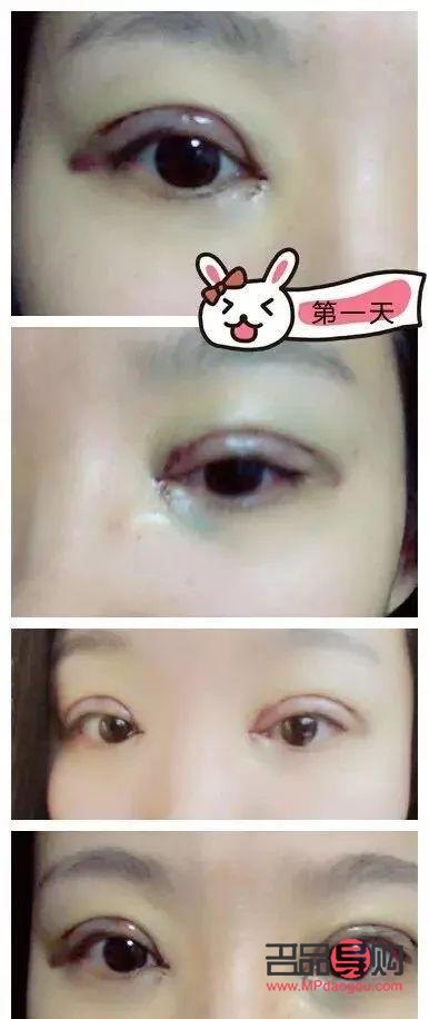 外雙眼皮好看還是內(nèi)雙眼皮好看(外雙眼皮好看還是內(nèi)雙眼皮好看呢)