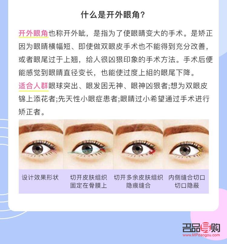 全切眼綜合涵蓋的眼部疾病范圍