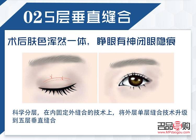 全切眼綜合涵蓋的眼部疾病范圍