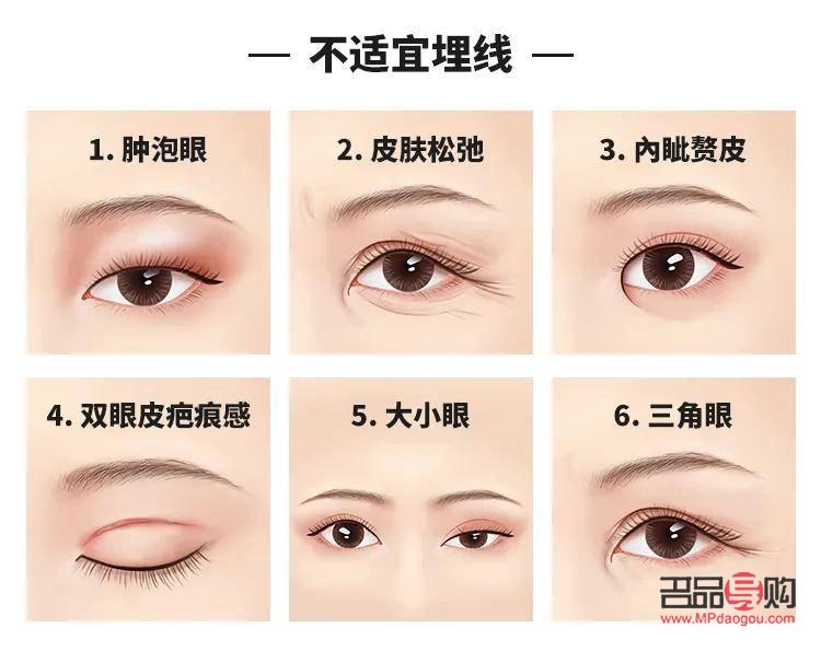全切眼綜合涵蓋的眼部疾病范圍