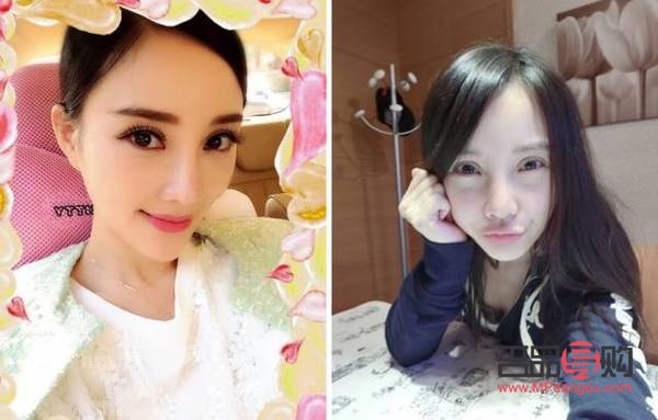 大雙眼皮圖片(歐式大雙眼皮圖片)