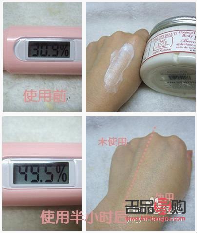 身體火燒怎么護(hù)理(身體火燒怎么護(hù)理最好)