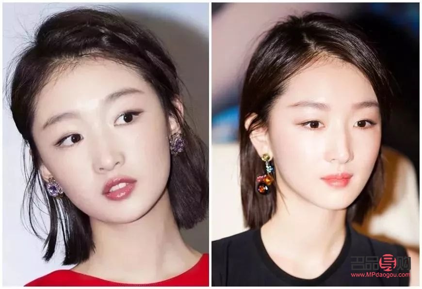 <h3>割雙眼皮能否實(shí)現(xiàn)內(nèi)雙效果？</h3>