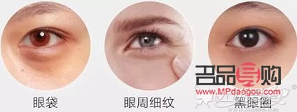 眼部衰老是什么原因(眼部衰老是什么原因造成的)