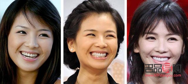 美容冠真的不好嗎(美容冠真的不好嗎)