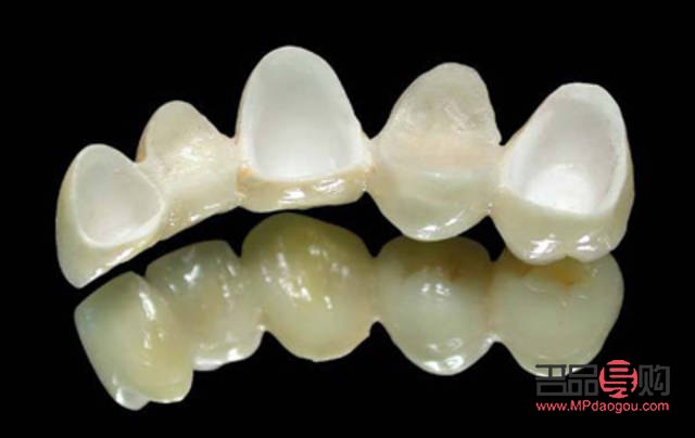 美容冠真的不好嗎(美容冠真的不好嗎)