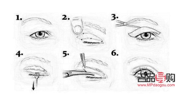 雙眼皮手術(shù)費(fèi)用知多少