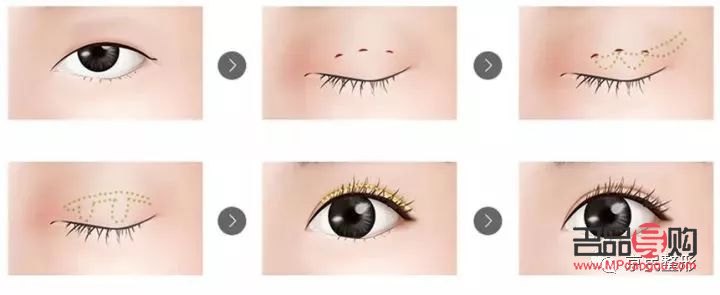 <h3>單眼皮變雙眼皮秘籍：非手術(shù)方法大揭秘</h3>